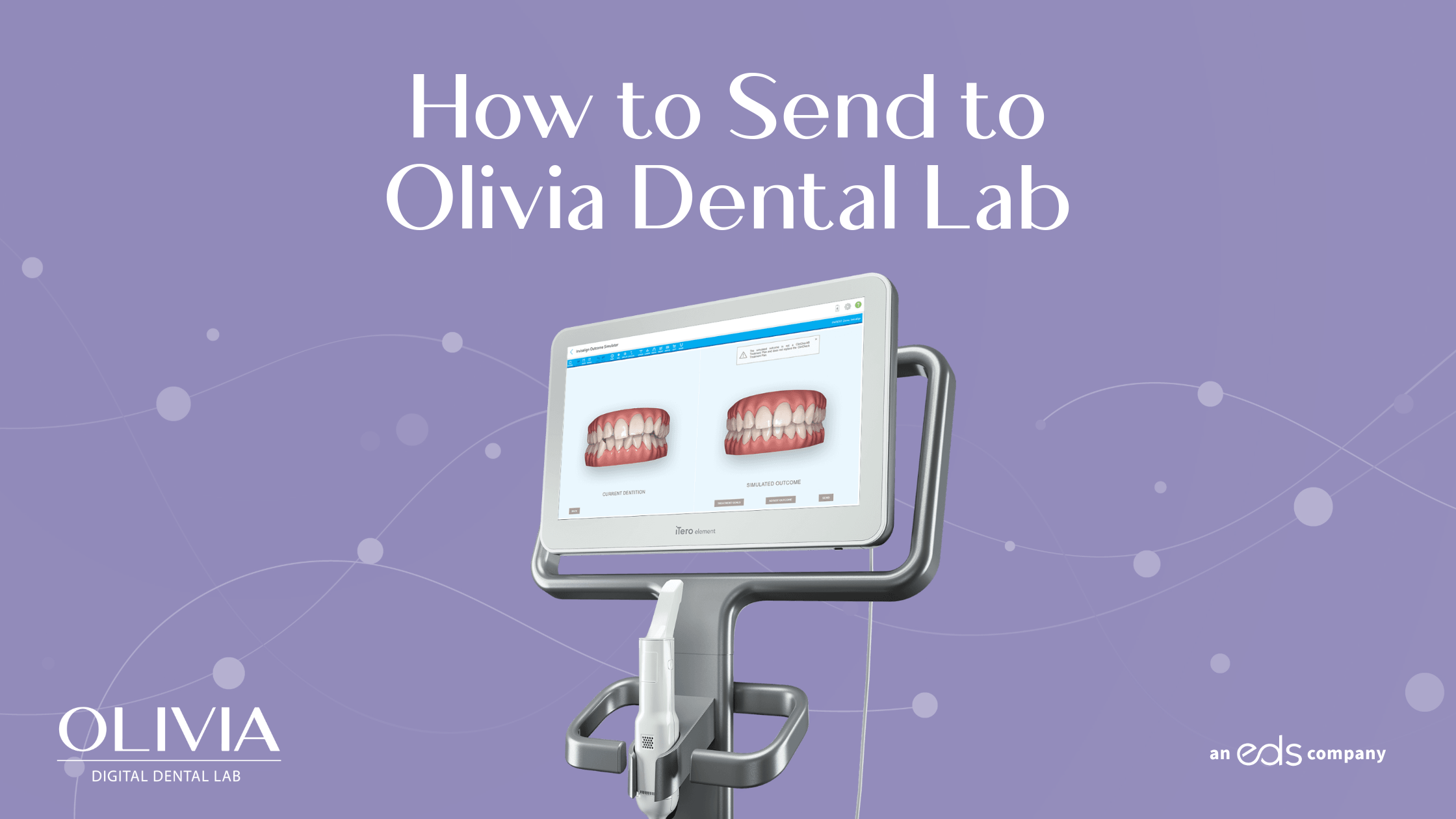 Featured image for “From iTero to Olivia Dental Lab: Simple Steps to a Seamless Experience”